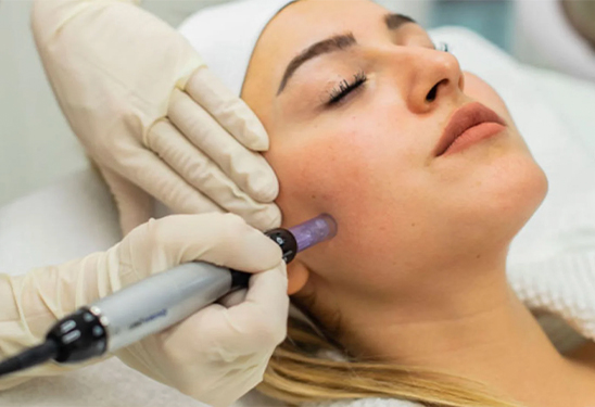 Dermapen